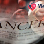 Cancerul:Diagnosticare si Tratament